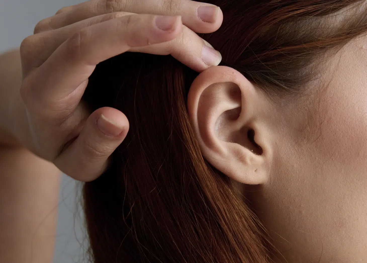 Photos avant/après chirurgie des oreilles décollées - Dr Runge, Paris 7 et Beauvais