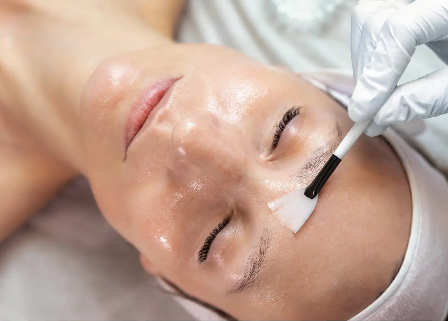 Les Peeling du visage - Dr Runge - Paris 7 et Beauvais (Oise)