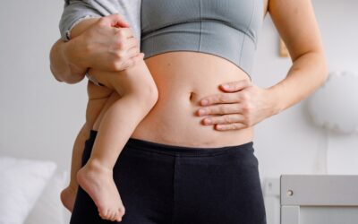 Abdominoplastie apres grossesse