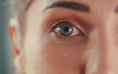resultats avant apres blepharoplastie effet jeunesse garanti | Dr Runge | Paris 7 et Paris 15