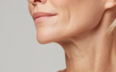 traiter double menton liposuccion | Dr Runge | Paris 7 et Paris 15
